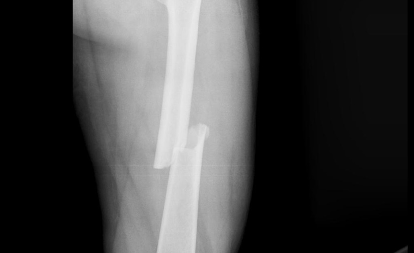 6d91c93a6a565320a67ff78ad8b240_jumbo