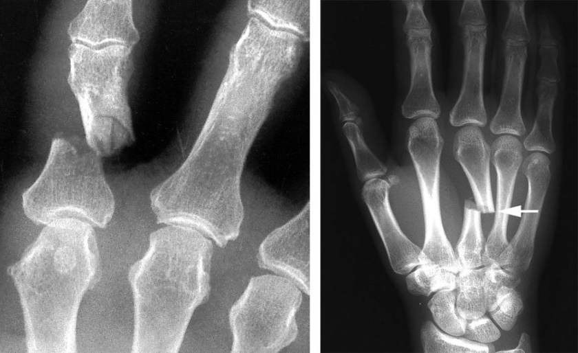 a00010f04a_kozinf2a-b_kh-compressor