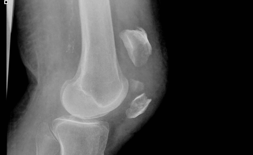 ffce4d6645f7af7c852e7e31d5ee9e